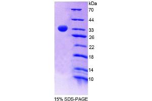 SDS-PAGE (SDS) image for Pyridoxamine 5'-Phosphate Oxidase (PNPO) (AA 1-261) protein (His tag) (ABIN4989500)