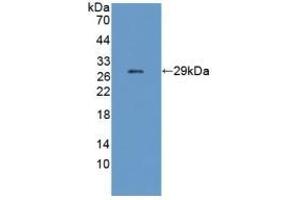 Detection of Recombinant CHRNe, Mouse using Polyclonal Antibody to Cholinergic Receptor, Nicotinic, Epsilon (CHRNe) (CHRNE antibody  (AA 21-239))