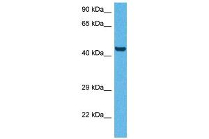 Host:  Rabbit  Target Name:  CD36  Sample Tissue:  Human HepG2 Whole Cell  Antibody Dilution:  1ug/ml (CD36 antibody  (N-Term))