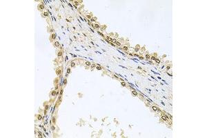 Immunohistochemistry of paraffin-embedded human prostate using MCL1 antibody (ABIN5970080) at dilution of 1/100 (40x lens). (MCL-1 antibody  (C-Term))