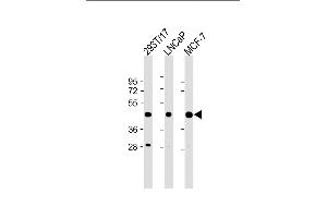 All lanes : Anti-PRMT6 (N-term) at 1:2000 dilution Lane 1: 293T/17 whole cell lysate Lane 2: LNCaP whole cell lysate Lane 3: MCF-7 whole cell lysate Lysates/proteins at 20 μg per lane. (PRMT6 antibody  (N-Term))