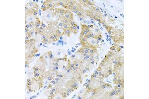 Immunohistochemistry of paraffin-embedded human stomach using HD antibody (ABIN6133740, ABIN6141667, ABIN6141668 and ABIN6216207) at dilution of 1:100 (40x lens). (HDAC3 antibody  (C-Term))