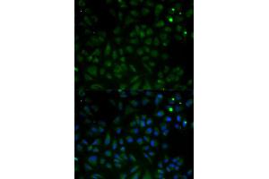 Immunofluorescence analysis of HeLa cells using VDAC1 antibody.