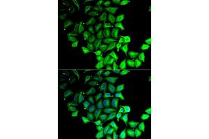 Immunofluorescence analysis of MCF-7 cell using RPS7 antibody.