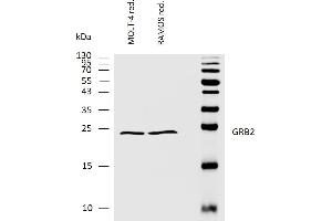 Western bloting analysis of human GRB2 using rabbit polyclonal antibody PAb (554) on lysates of MOLT-4 and RAMOS cell lines under reducing conditions. (GRB2 antibody  (AA 198-217))
