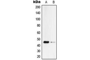 Western blot analysis of Serpin B4 expression in HepG2 (A), PC12 (B) whole cell lysates. (SERPINB4 antibody  (Center))