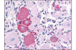 Image no. 1 for anti-Transient Receptor Potential Cation Channel, Subfamily V, Member 2 (TRPV2) (N-Term) antibody (ABIN302577)