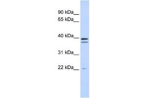 WB Suggested Anti-RABGGTB Antibody Titration:  0.