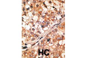 Immunohistochemistry (IHC) image for anti-BCL2-Like 11 (Apoptosis Facilitator) (BCL2L11) (BH3 Domain) antibody (ABIN2997135) (BIM antibody  (BH3 Domain))