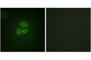 Immunofluorescence analysis of A549 cells, using PKD1/PKC mu (Ab-205) Antibody. (PKC mu antibody  (AA 171-220))