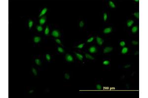 Immunofluorescence of purified MaxPab antibody to C7orf16 on HeLa cell. (G Substrate antibody  (AA 1-155))