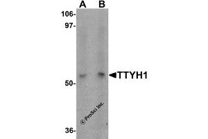 Western Blotting (WB) image for anti-Tweety Homolog 1 (TTYH1) (C-Term) antibody (ABIN1030786) (TTYH1 antibody  (C-Term))