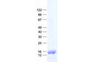 Validation with Western Blot (MRPL14 Protein (His tag))