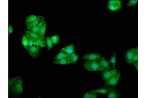Immunofluorescence staining of HepG2 cells with ABIN7144603 at 1:66, counter-stained with DAPI. (ATE1 antibody  (AA 105-253))