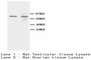 Image no. 1 for anti-BRCA1 Associated Protein-1 (Ubiquitin Carboxy-terminal Hydrolase) (BAP1) antibody (Magnetic Particles) (ABIN1502068) (BAP1 antibody  (Magnetic Particles))