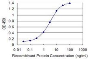 Detection limit for recombinant GST tagged ZBTB6 is 0. (ZBTB6 antibody  (AA 121-220))
