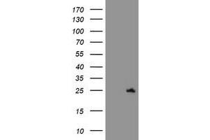 HEK293T cells were transfected with the pCMV6-ENTRY control (Left lane) or pCMV6-ENTRY C21orf56 (Right lane) cDNA for 48 hrs and lysed. (C21ORF56 antibody)