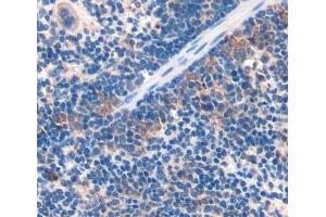 #VALUE! (DNHD1 antibody  (AA 1-302))