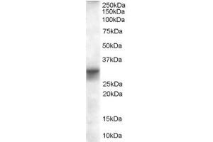 Western Blotting (WB) image for anti-Four and A Half LIM Domains 1 (FHL1) (AA 233-246) antibody (ABIN297027) (FHL1 antibody  (AA 233-246))