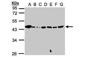 WB Image Sample(30μg whole cell lysate) A: 293T B: A431 , C: H1299 D: HeLa S3 , E: Hep G2 , F: MOLT4 , G: Raji , 10% SDS PAGE antibody diluted at 1:1000 (MPI antibody)