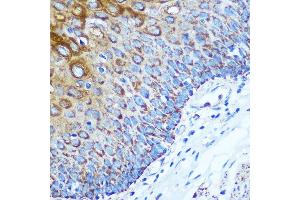 Immunohistochemistry of paraffin-embedded Human esophageal using WWC1 Rabbit pAb (ABIN7271388) at dilution of 1:100 (40x lens).