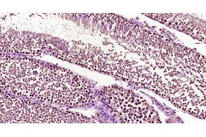 Paraformaldehyde-fixed, paraffin embedded Mouse testis, Antigen retrieval by boiling in sodium citrate buffer (pH6. (TOX2 antibody  (AA 201-300))