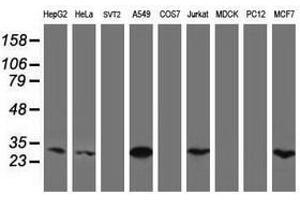 Image no. 4 for anti-Mitochondrial Translational Initiation Factor 3 (MTIF3) (AA 56-278) antibody (ABIN1491591) (MTIF3 antibody  (AA 56-278))
