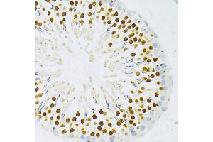 Immunohistochemistry of paraffin-embedded rat testis using DP1/DP1/TFDP1 antibody (ABIN7270892) at dilution of 1:100 (40x lens). (DP1 antibody  (AA 1-290))