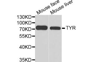 Western blot analysis of extracts of mouse face and mouse liver  tissues, using TYR antibody. (TYR antibody)