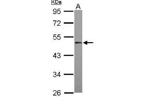 WB Image Sample (30 ug of whole cell lysate) A: HepG2 10% SDS PAGE antibody diluted at 1:1000 (MAPKAP Kinase 5 antibody)