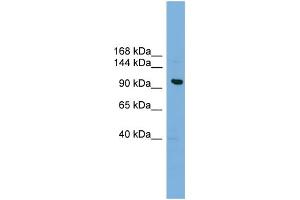 WB Suggested Anti-VPS41 Antibody Titration: 0.
