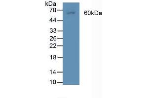 Figure. (BMPR2 antibody  (AA 27-150))