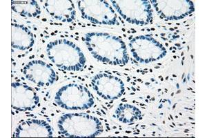 Immunohistochemical staining of paraffin-embedded Kidney tissue using anti-CHEK2mouse monoclonal antibody.
