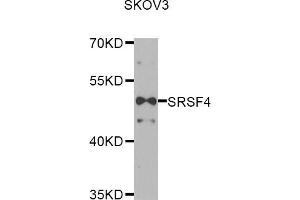Western blot analysis of extracts of SKOV3 cells, using SRSF4 antibody (ABIN5974197) at 1/1000 dilution.