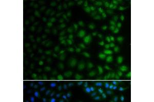 Immunofluorescence analysis of A549 cells using NAA40 Polyclonal Antibody (NAA40 antibody)