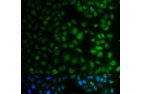 NAA40 antibody