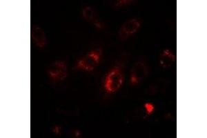 Immunofluorescent analysis of LC3A staining in HepG2 cells. (MAP1LC3A antibody)