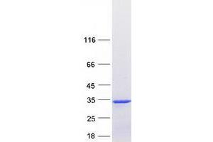 Western Blotting (WB) image for Mitochondrial Ribosome Recycling Factor (MRRF) (Transcript Variant 1) protein (Myc-DYKDDDDK Tag) (ABIN2726425)