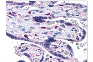 Human Placenta: Formalin-Fixed, Paraffin-Embedded (FFPE) (SNX16 antibody  (N-Term))