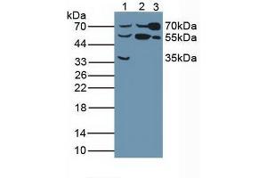 Figure. (Butyrylcholinesterase antibody  (AA 29-150))