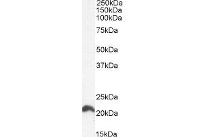 (ABIN302138) (0. (GTPase NRas antibody  (Internal Region))