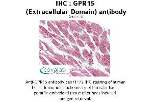 Image no. 1 for anti-G Protein-Coupled Receptor 15 (GPR15) (2nd Extracellular Domain) antibody (ABIN1734958) (GPR15 antibody  (2nd Extracellular Domain))