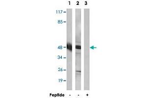 Western blot analysis of extracts from HeLa cells (Lane 1 and lane 3) and COLO 205 cells (Lane 2), using ACOT4 polyclonal antibody . (ACOT4 antibody)