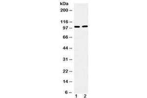 Western blot testing of 1) mouse testis and 2) human U87 cell lysate with TACC1 antibody at 0. (TACC1 antibody  (AA 196-235))