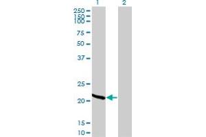 Western Blot analysis of RCV1 expression in transfected 293T cell line by RCV1 monoclonal antibody (M42A), clone 3H1.