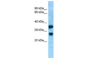 Host:  Rabbit  Target Name:  Aqp8  Sample Type:  Rat Small Intestine lysates  Antibody Dilution:  1. (Aquaporin 8 antibody  (Middle Region))