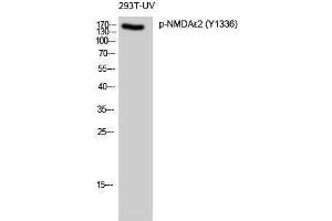 Western Blotting (WB) image for anti-NMDA epsilon 2 (pTyr1336) antibody (ABIN3173327) (NMDA epsilon 2 (pTyr1336) antibody)