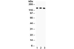 Western blot testing of 1) rat liver, 2) mouse liver and 3) human SMMC lysate with ABCB11 antibody. (ABCB11 antibody)