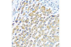 Immunohistochemistry of paraffin-embedded human liver using LRPPRC antibody at dilution of 1:100 (40x lens). (LRPPRC antibody)