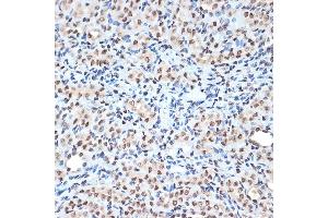 Immunohistochemistry (IHC) image for anti-Histone Cluster 1, H2ae (HIST1H2AE) antibody (ABIN7267703)